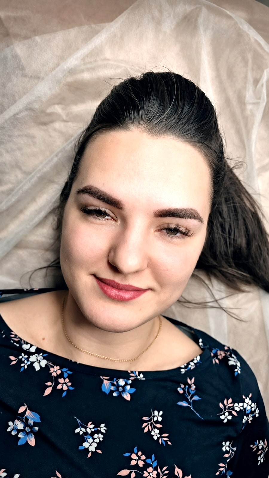 Клиентка ADORe сразу после процедуры